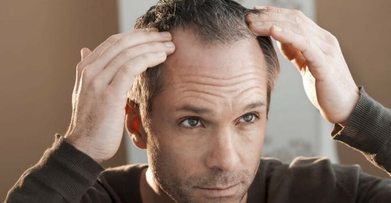 Are you losing hair due to stress? - Balding Life