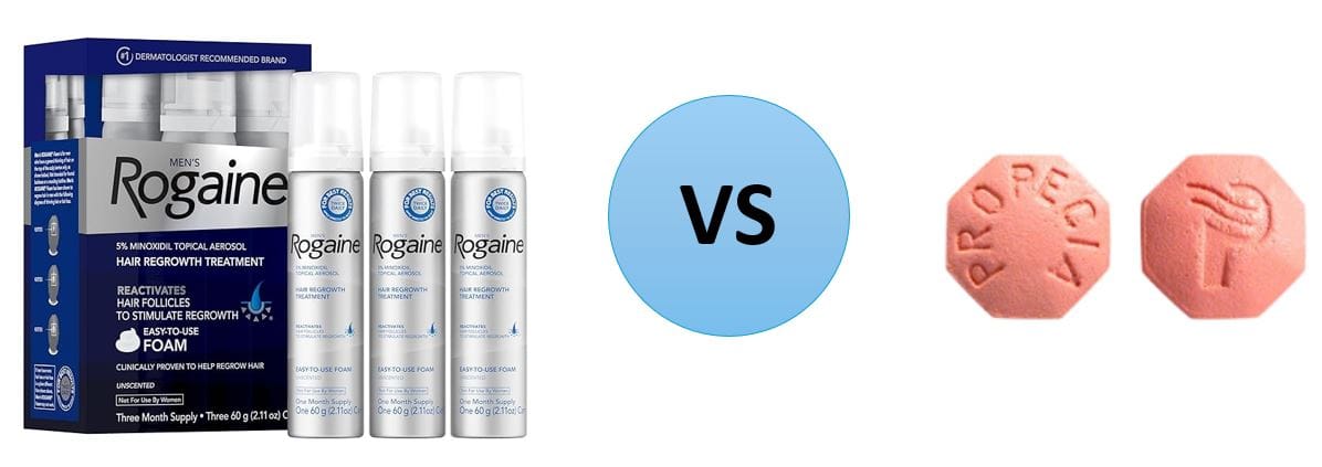 Minoxidil-vs-Finasteride